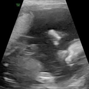 Meet your Posher, Martita